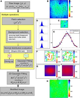 Single Image-Based Vignetting Correction for Improving the Consistency of Neural Activity Analysis in 2-Photon Functional Microscopy